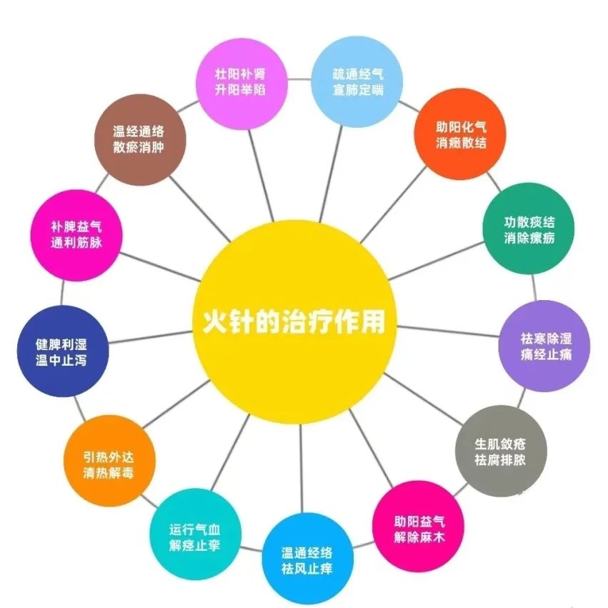 An Overview of Fire Needle Therapy in Traditional Chinese Medicine