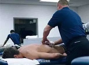 Cupping Therapy Shines at the Rio Olympics