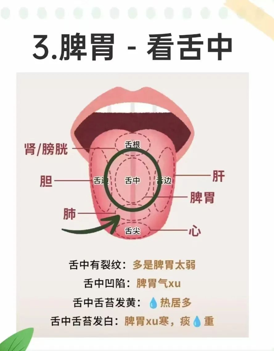 Tongue Diagnosis and the Five Organs