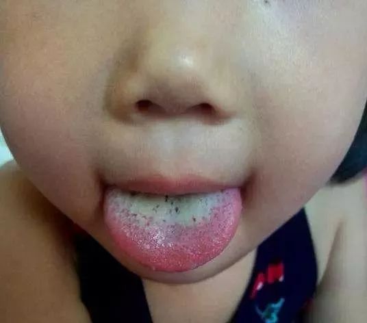 The TCM Tongue Diagnosis Atlas is Here! Observe the Tongue to Understand the Whole Body!