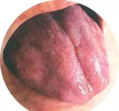 130 High-Definition Tongue Diagnosis Charts (Recommended for Collection)