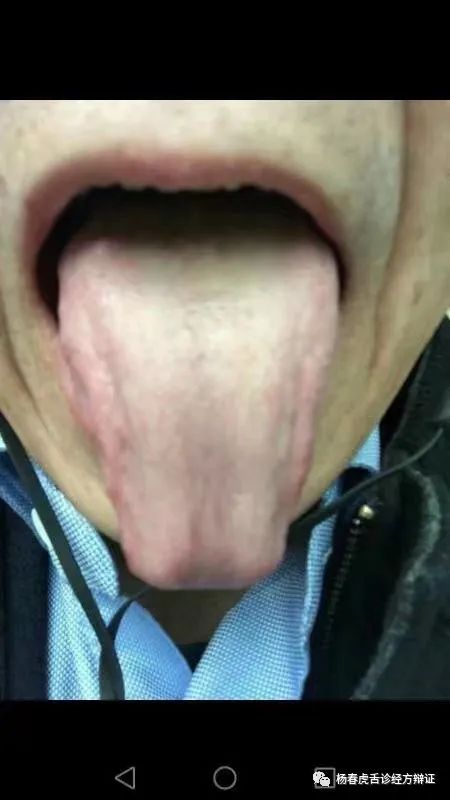Foundations of Traditional Chinese Medicine: Phlegm-Dampness