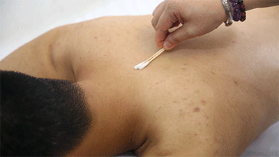 A Comprehensive Guide to Cupping Therapy