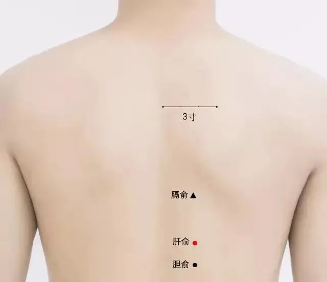 Anxiety? Quickly Relieve Your Mood with Moxibustion!