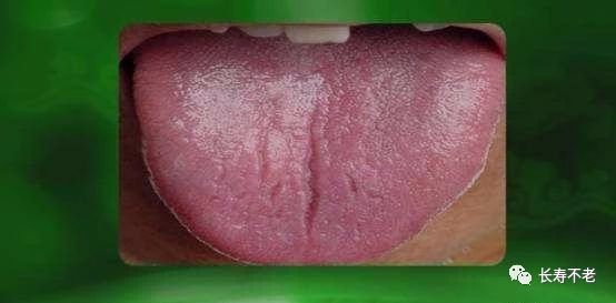 The Most Comprehensive TCM Tongue Diagnosis Atlas: Observe the Tongue, Understand the Whole Body!