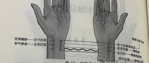 Learn to Take the Pulse in Five Minutes