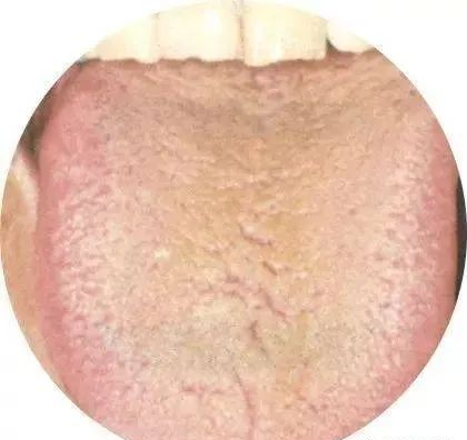 130 High-Definition Tongue Diagnosis Charts (Recommended for Collection)