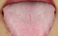 What is Qi Deficiency and What Symptoms Does It Present?