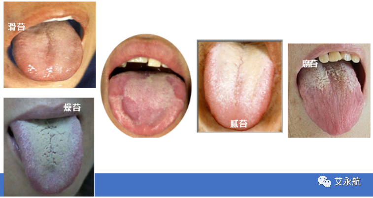 Understanding Disease Through Tongue Diagnosis in Traditional Chinese Medicine