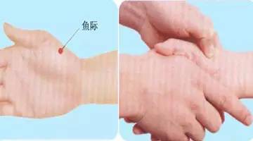Three Forbidden Acupuncture Points in Acupuncture: Remember These to Get Started