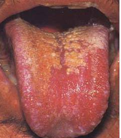 62 High-Definition Tongue Diagnosis Charts with Illustrations (Collector's Edition)