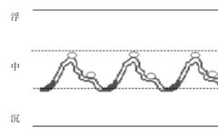 The Significance of Slippery Pulse Beyond Pregnancy Indication