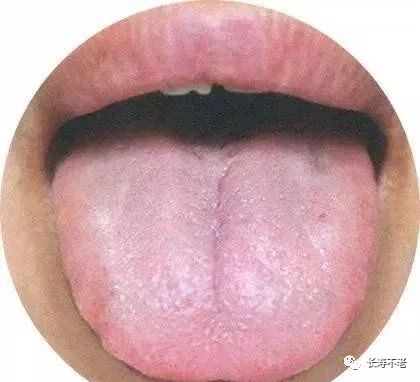 The Most Comprehensive TCM Tongue Diagnosis Atlas: Observe the Tongue, Understand the Whole Body!