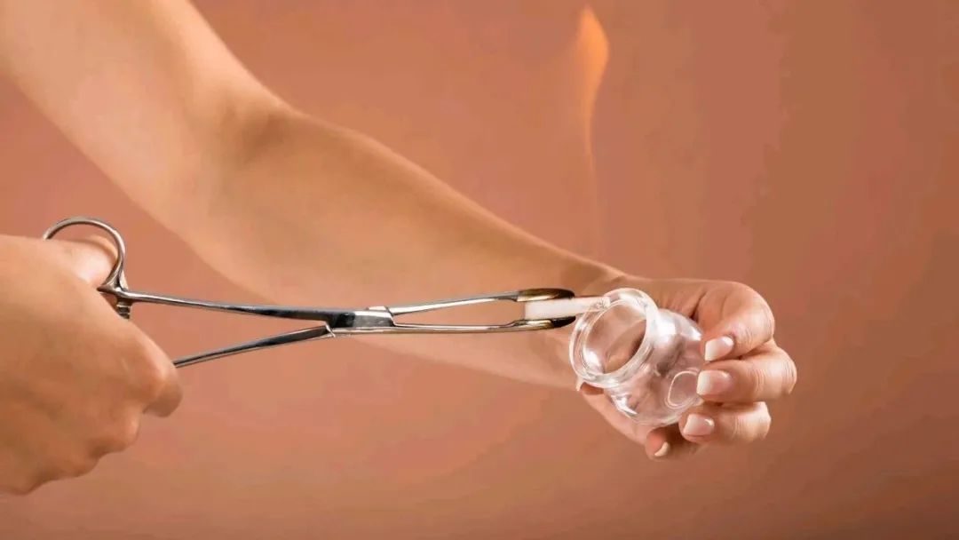 Traditional Chinese Medicine Rehabilitation Techniques for Neurological Disorders