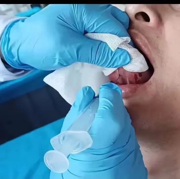 The Unique External Treatment Methods of the TCM Comprehensive Diagnosis and Treatment Center - Part Three