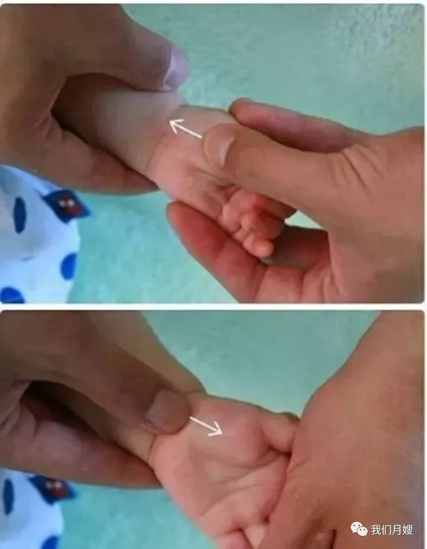 21 Techniques of Pediatric Tuina: Simple and Easy to Learn with Animated Demonstrations