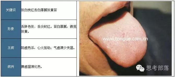 Comprehensive Guide to Tongue Diagnosis (8): 72 Types of Tongue Diagnosis Charts