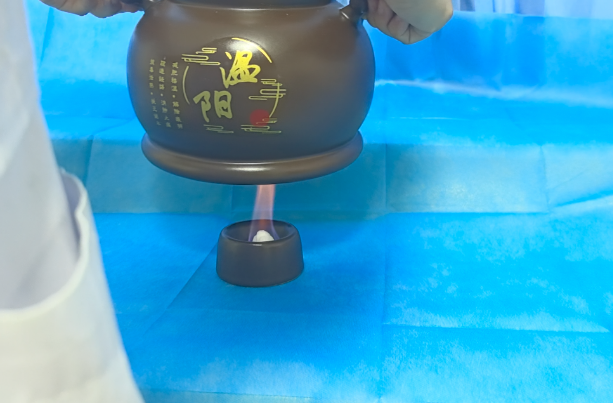 Warming Yang Cupping: Balancing Yin and Yang to Prevent Autumn Dryness