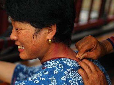 10 Gua Sha Techniques to Relieve Various Ailments Using a Spoon