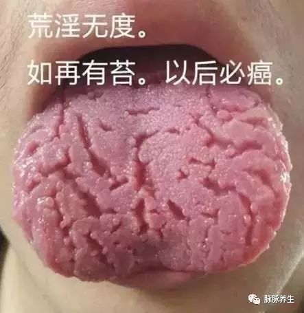 Tongue Diagnosis: A Clear Insight