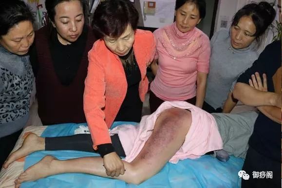 Why Gua Sha Should Not Be Limited to the Back: The Wonders of Gua Sha