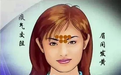 Comprehensive Guide to Facial Diagnosis in Traditional Chinese Medicine (With Images and Explanations)