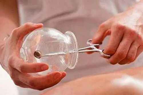 The Miraculous Effects of Cupping on the Navel