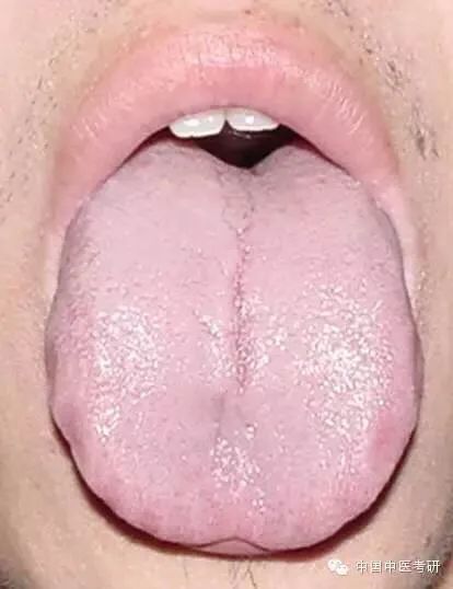 Tongue Diagnosis - Illustrated Guide to Tongue Manifestations