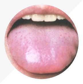 Analysis of High-Definition Tongue Diagnosis Charts: Understanding Health Through Your Tongue (Part 1)
