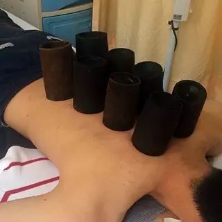 Traditional Chinese Medicine Bamboo Cupping: Have You Tried It?