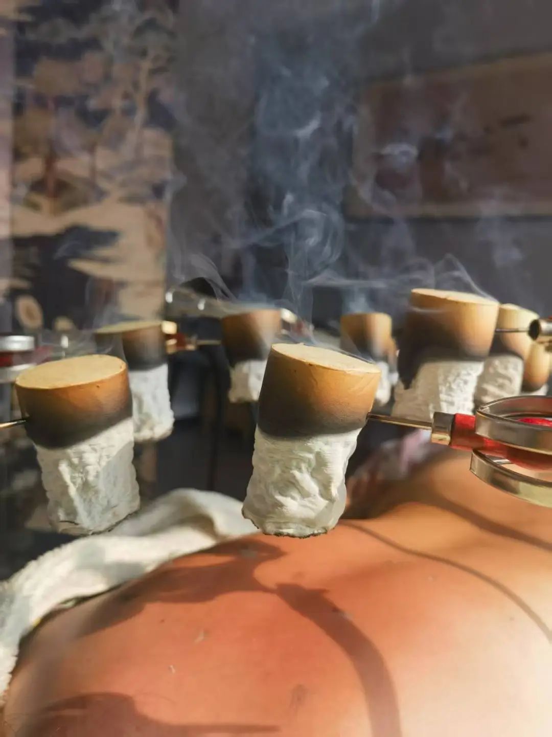 Daily Moxibustion | The Right Time to Regulate Blood Stasis in the Body Has Arrived