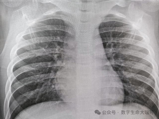 High Fever of 39.5℃ on a Rainy Night: The 87 Minutes of Wrong Choices Between Two AI Consultations