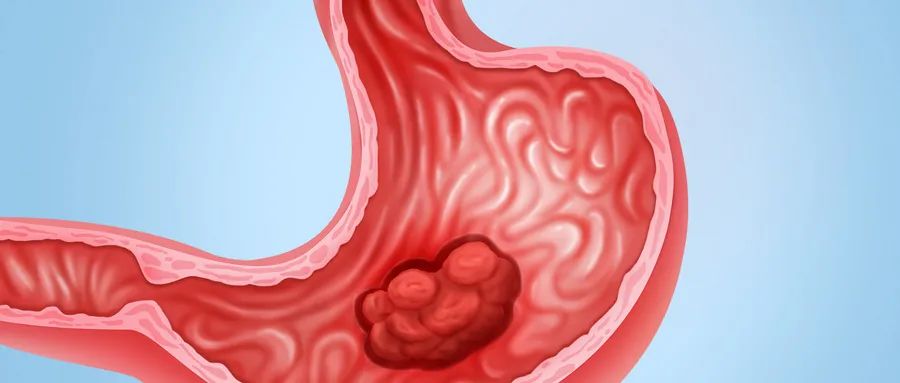 7 Major Symptoms of Spleen and Stomach Yang Deficiency: How Many Do You Have? 6 Effective Remedies to Nourish Spleen and Stomach.