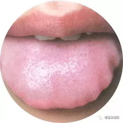 Learn Quick Ways to Observe Tongue Quality and Coating to Understand Your Health and Diseases!