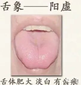 Exploring Tongue Diagnosis in Traditional Chinese Medicine: Hidden Insights and Tongue Diagnosis Atlas