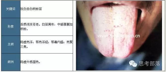 Comprehensive Guide to Tongue Diagnosis (8): 72 Types of Tongue Diagnosis Charts