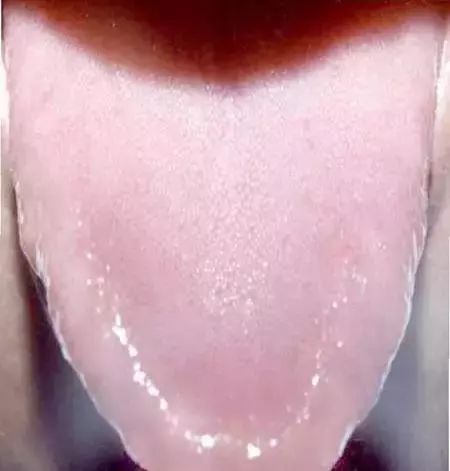 The Most Comprehensive Guide to Tongue Diagnosis! Master It and Become a Tongue Diagnosis Expert