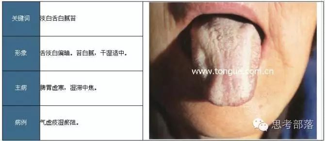 Comprehensive Guide to Tongue Diagnosis (8): 72 Types of Tongue Diagnosis Charts
